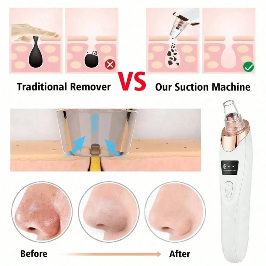 5 พลังดูด Blackhead Remover Pore สูญญากาศ,ผู้หญิง Blackhead Remover Pore สูญญากาศ,FacialPoreCleaner ชุดสําหรับผู้ใหญ่ ExtractorTool