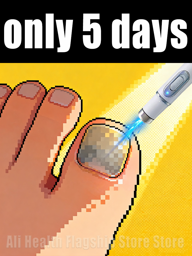 The fifth generation of champagne-colored nail laser penʜᴇʟᴘs ʏᴏᴜ sᴀʏ ɢᴏᴏᴅʙʏᴇ ᴛᴏ ᴏɴʏᴄʜᴏᴍʏᴄᴏsɪs. Tᴇᴄʜɴᴏʟᴏɢʏ ᴄʜᴀɴɢᴇs ʏᴏᴜʀ ʟɪharᴇ。