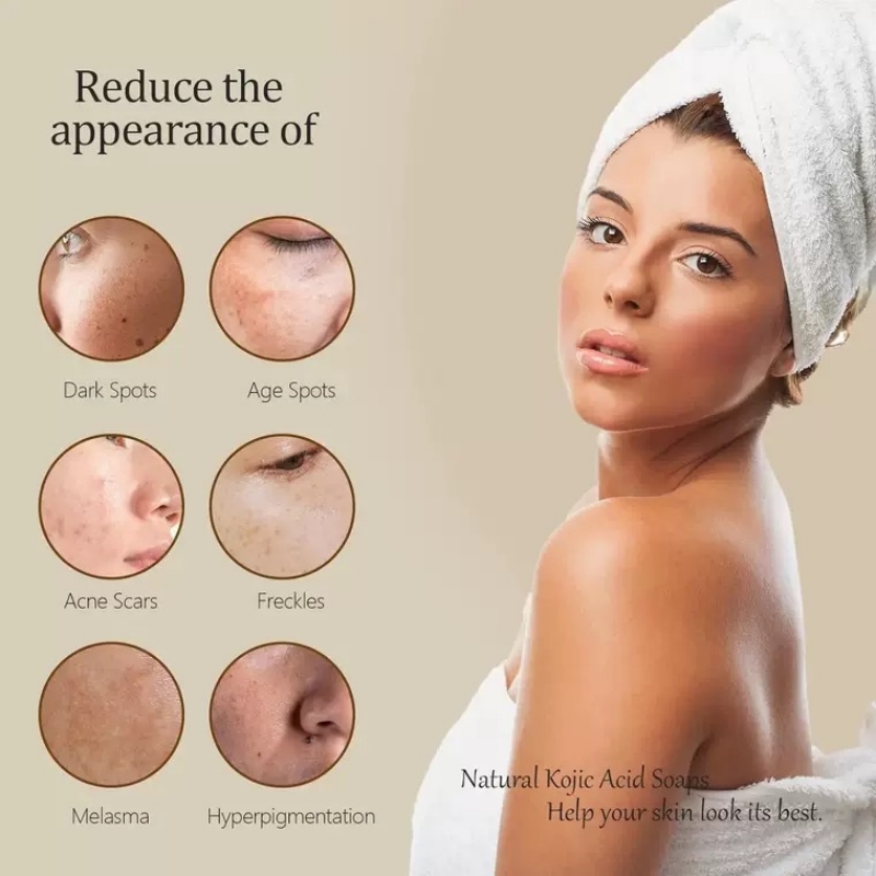 สบู่กรดโคจิกมะนาวขมิ้นกระจ่างใสสําหรับผิวคล้ําเรืองแสงสีผิวสม่ําเสมอ Smooth Deep Cleanser Oil Control Face Skin Care