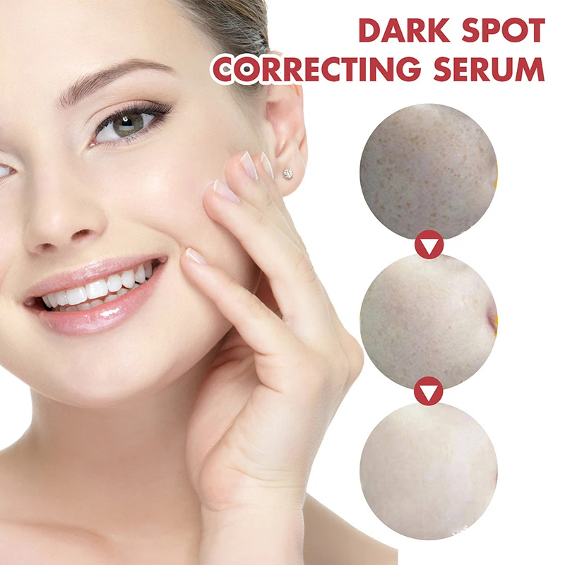 Suero de niacinamida, corrector de manchas oscuras, hidratante, brillo, decoloración de líneas finas, limpieza profunda, removedor de maquillaje, cuidado de la piel coreano