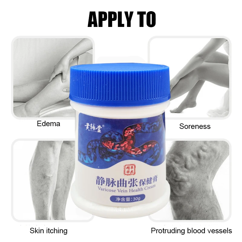 Giãn Tĩnh Mạch Kem Điều Trị Viêm Mạch Phlebitis Nhện Giảm Đau Tinh Dầu Varicosity Angiitis Loại Bỏ 100% Nguyên Bản Thảo Dược