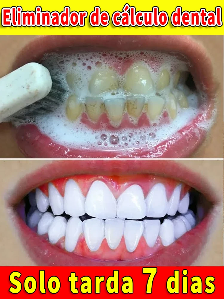 Resolver todos los problemas dentales