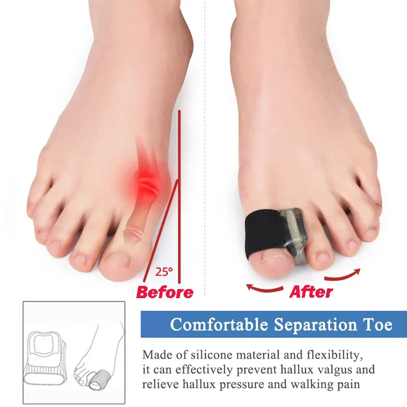 2/4Pcs Gel Toe Separators Bunion Corrector for Bunion Overlapping and Hammer Toe Relief with Toe Spacers Toe Tube