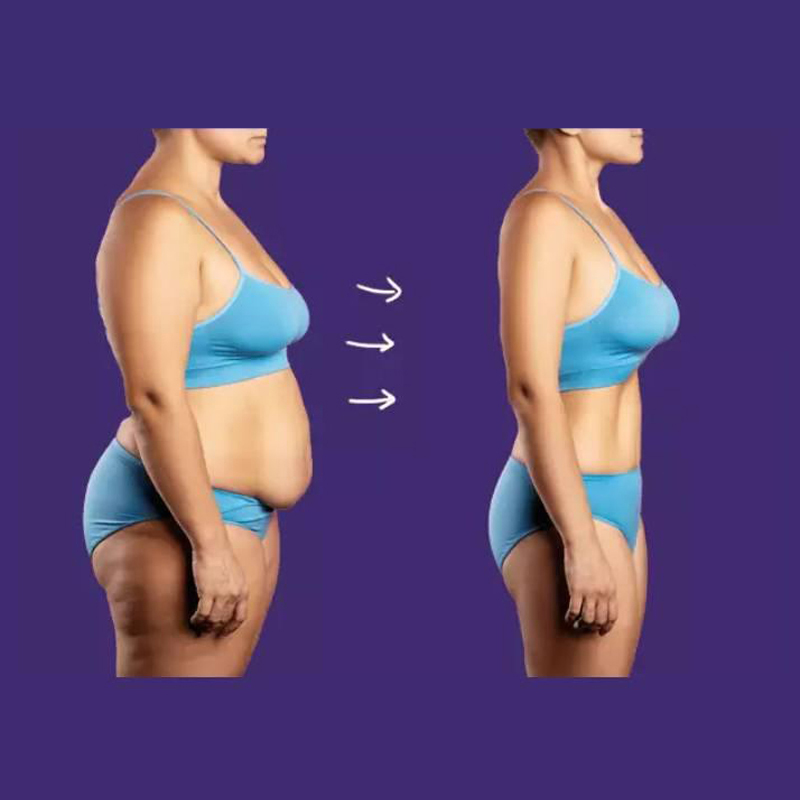 VIP-L'effet le plus fort Tingmei