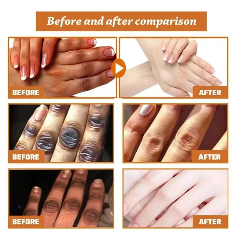 Fast Whitening Dark Knuckles Cream Brighten Hand Cream Lighten Melanin Stains Corrector Hand Anti Crack Soften Moisturize Produc