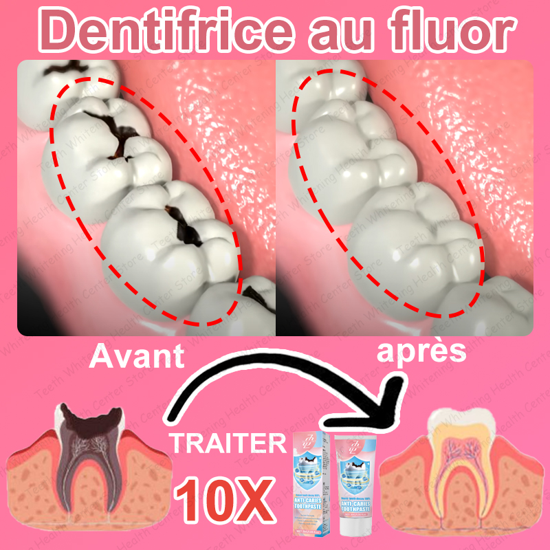 99% ᴅᴇ ᴘᴇʀsᴏɴɴᴇs ʀᴀᴄʜᴇᴛᴇʀ, ᴠᴇɴᴅʀᴇ ᴀ̀ ᴄʜᴀᴜᴅ, ʀᴇ́ᴘᴀʀᴇʀ ʟᴀ ᴄᴀʀɪᴇ ᴅᴇɴᴛᴀɪʀᴇ