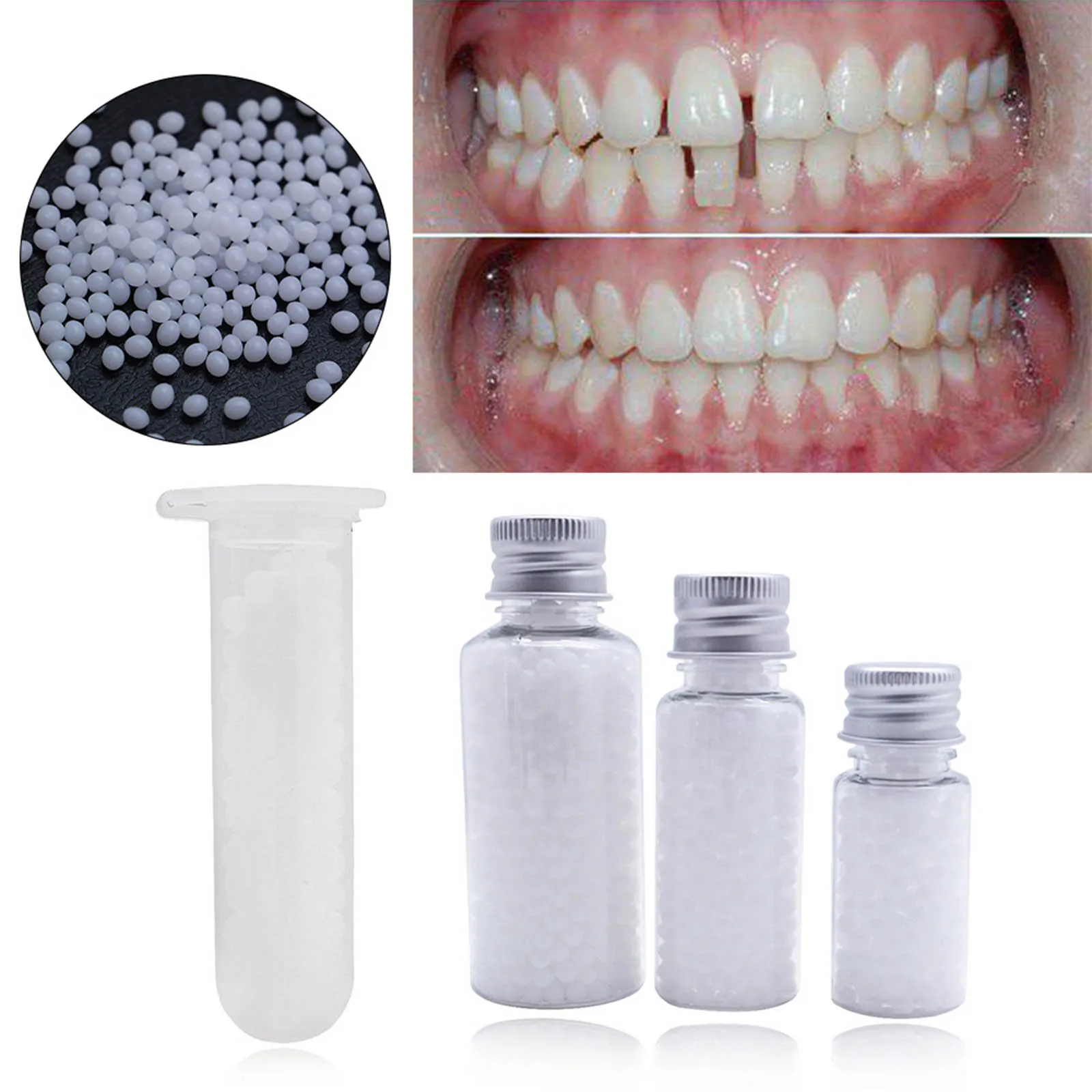 10G Temporary Tooth Solid Glue Fix Missing Broken Gaps Filling Temporary Veneer Teeth Replacements Molding Beads