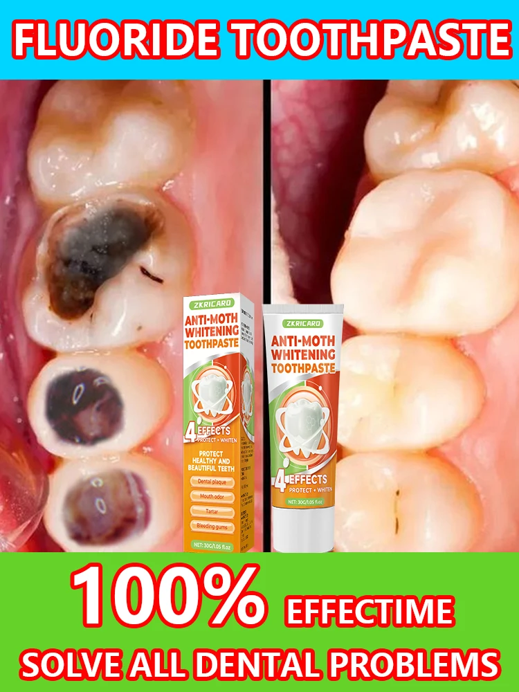 Clarear Reparación De Creme Dental, restauración Dente