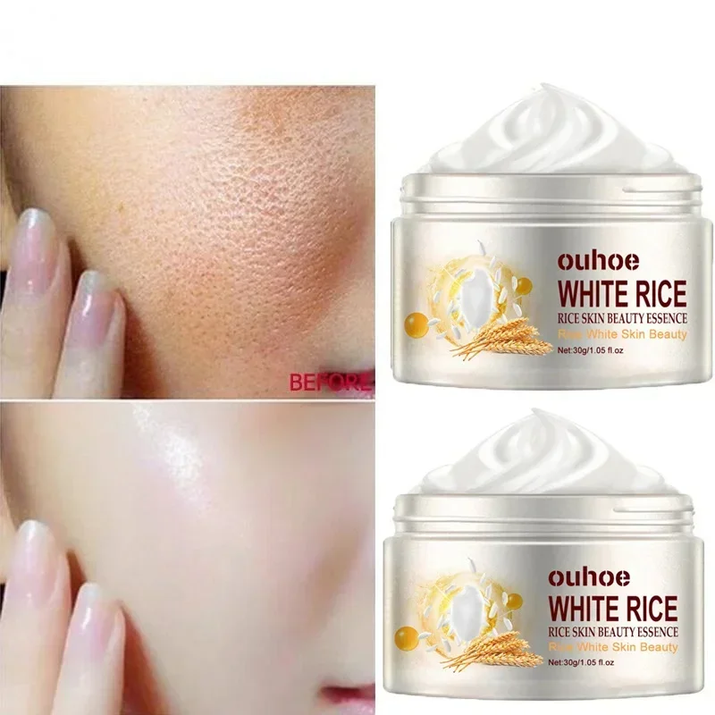 Creme de clareamento facial de arroz branco, remove manchas escuras, desbota sardas, melanina, antirrugas, envelhecimento, hidratante, ilumina, cuidados com a pele, novo