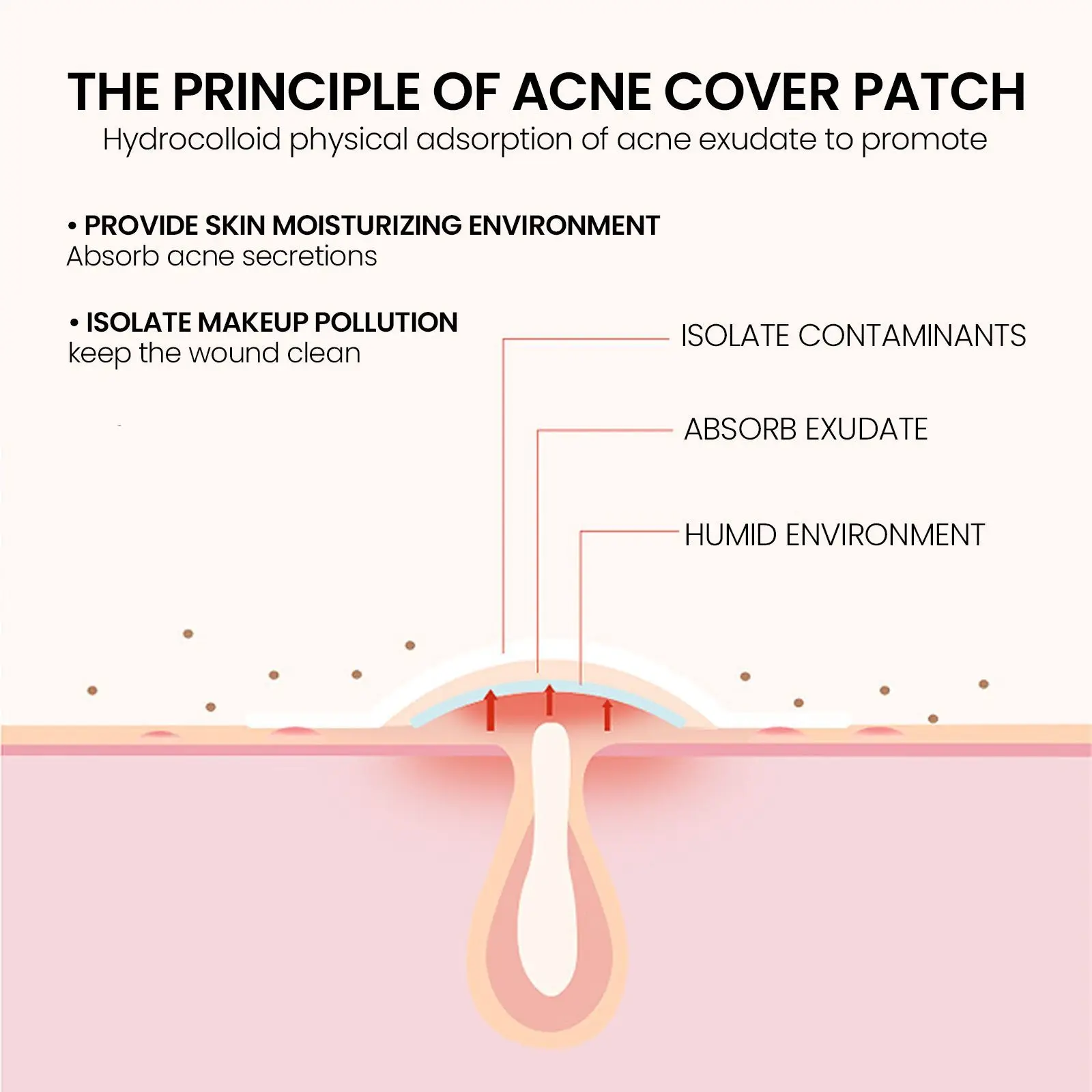 240 pieces of multi-color star acne patches, facial acne patches, concealer acne patches, and pimples patches, ultra-thin