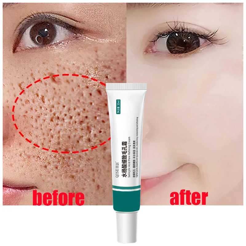 Hot Salicylic Acid Pore Shrinking Cream Quick Elimination Large Pores Remove Blackehead Tighten Face Smooth Skin Care Products
