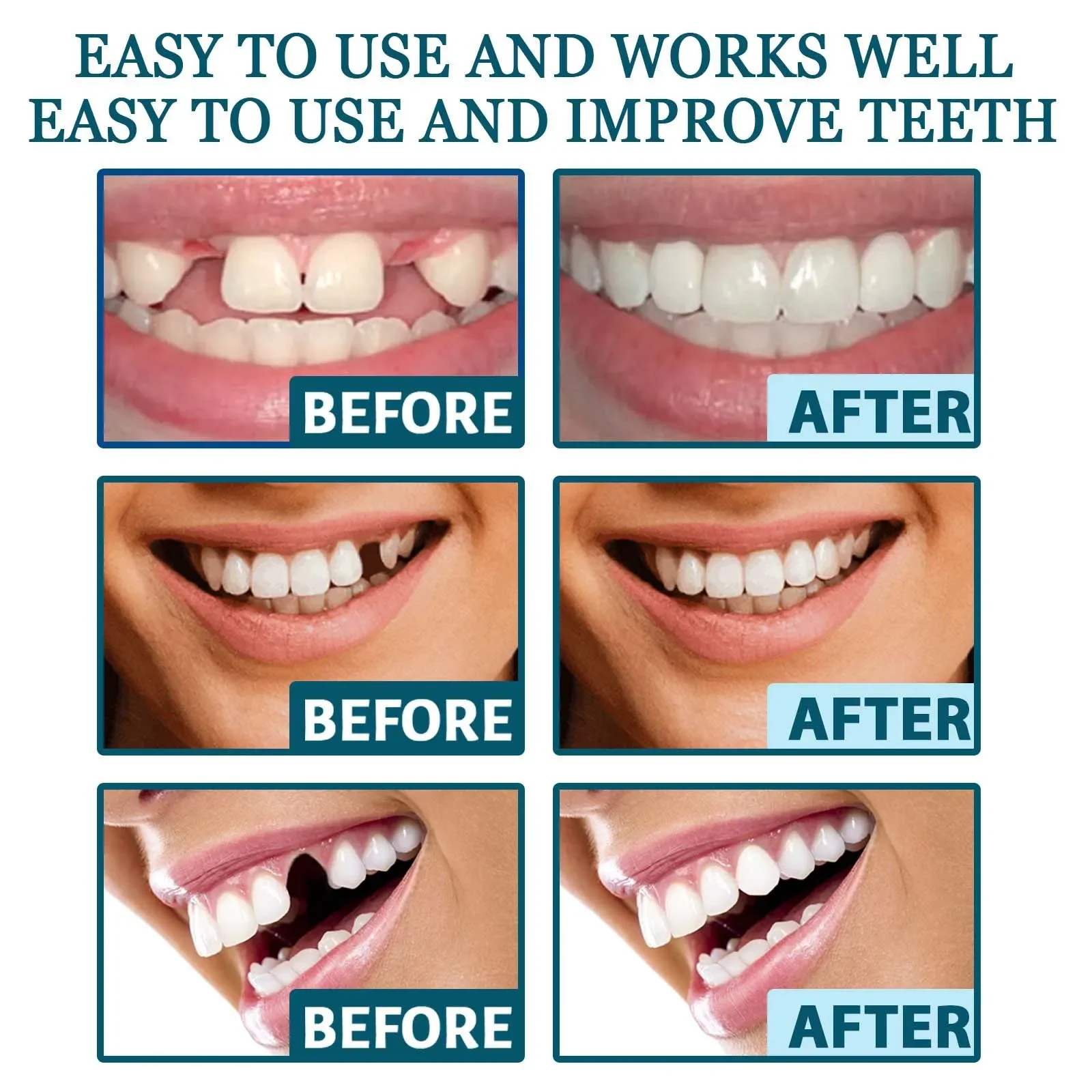 Adjustable Teeth Set Whitening Dentures Temporary Perfect Smile False Teeth Upper Lower Removable Dental Veneers Fake Tooth Set