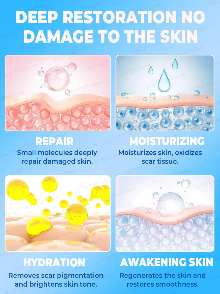 Crema para eliminar cicatrices. Elimina eficazmente las cicatrices de heridas y repara las cicatrices.