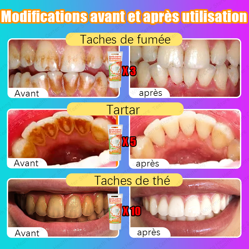 Taux de rachat 98%, vous pouvez avoir des dents saines sans nettoyage des dents, recommandé par les dentistes
