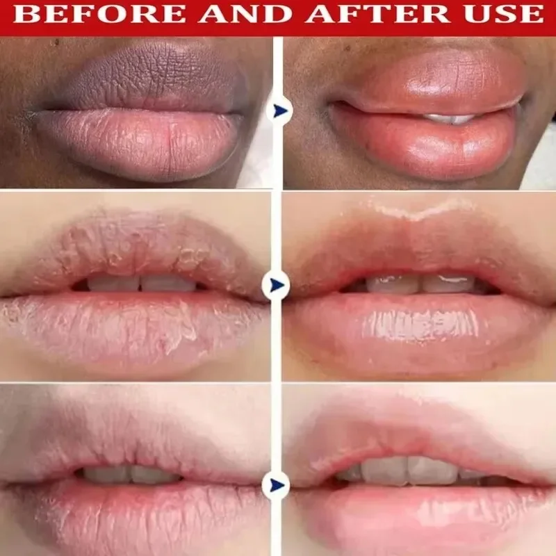 Bálsamo labial para eliminar la oscuridad, máscara de melanina iluminadora, brillo exfoliante, tratamiento rosa para labios, Reduce las líneas de los labios, mejora la sequedad, hidratante