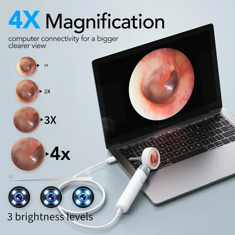 Smart Ear Camera Endoscope 90° Rotatable Head for Easy Viewing 1080P HD Camera with 12 Replacement Heads Included /Nose /Skin