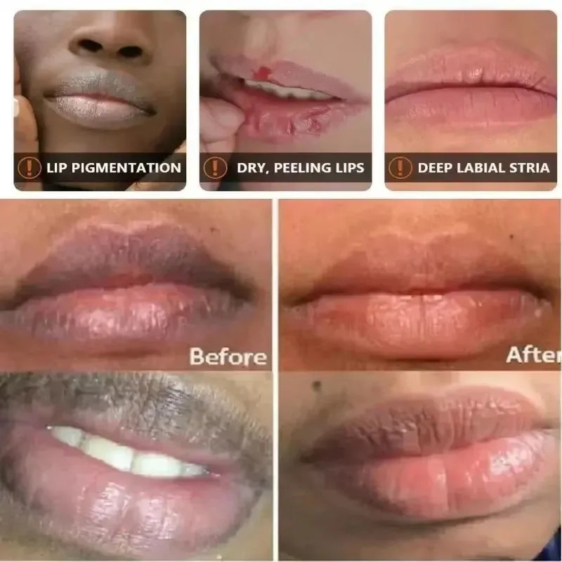 Bálsamo labial para eliminar la oscuridad, máscara de melanina iluminadora, brillo exfoliante, tratamiento rosa para labios, Reduce las líneas de los labios, mejora la sequedad, hidratante