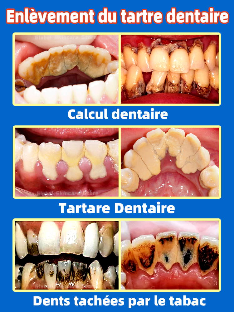 Résoudre les problèmes dentaires