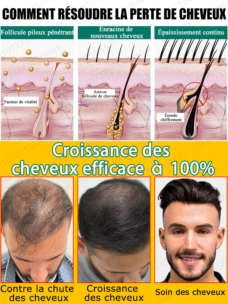 Le petit flacon bleu WPRBREGT nourrit en profondeur le cuir chevelu, revitalise les follicules pileux et favorise une croissance rapide des cheveux en 7 jours