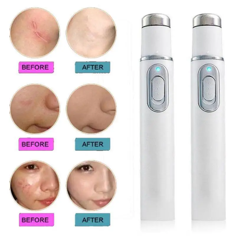 Relieve Eye Fatigue Soothe Tired Eyes Portable And Convenient Voltage Dc1.5v Cutting-edge Current 0.6a Powerful Eye Spa Tool