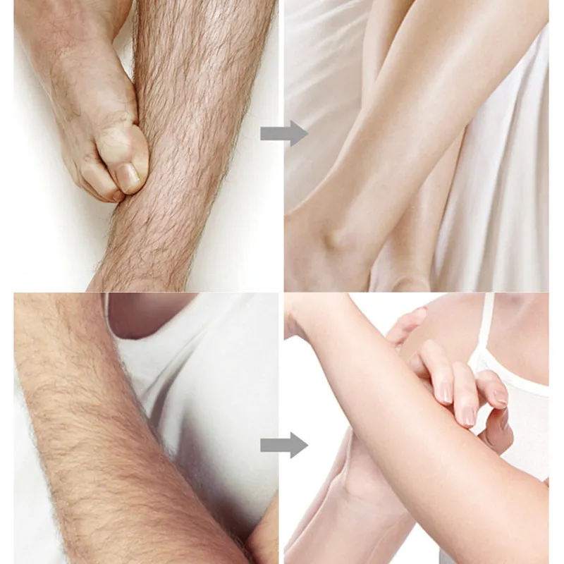 20stick Professional Hair Removal Wax Strips for Summer Depilation Double Sided Cold Wax Paper for Leg Body Face Useful