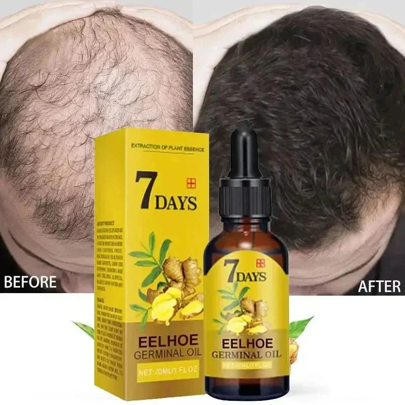 Ginger Hair Growth Serum Anti Hair Loss หัวล้าน Fast Regrowth Hair Care Oil Repair ผมเสียหนังศีรษะสําหรับผู้หญิงผู้ชาย