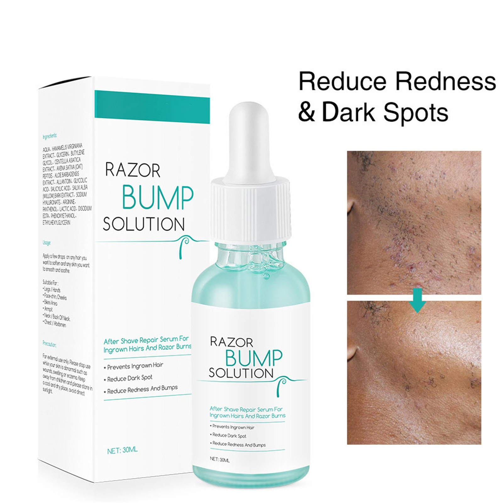 Serum lembut Anti pertumbuhan rambut 30ml, Serum perbaikan dan benturan, Serum pencegah pertumbuhan rambut, Serum setelah mencukur