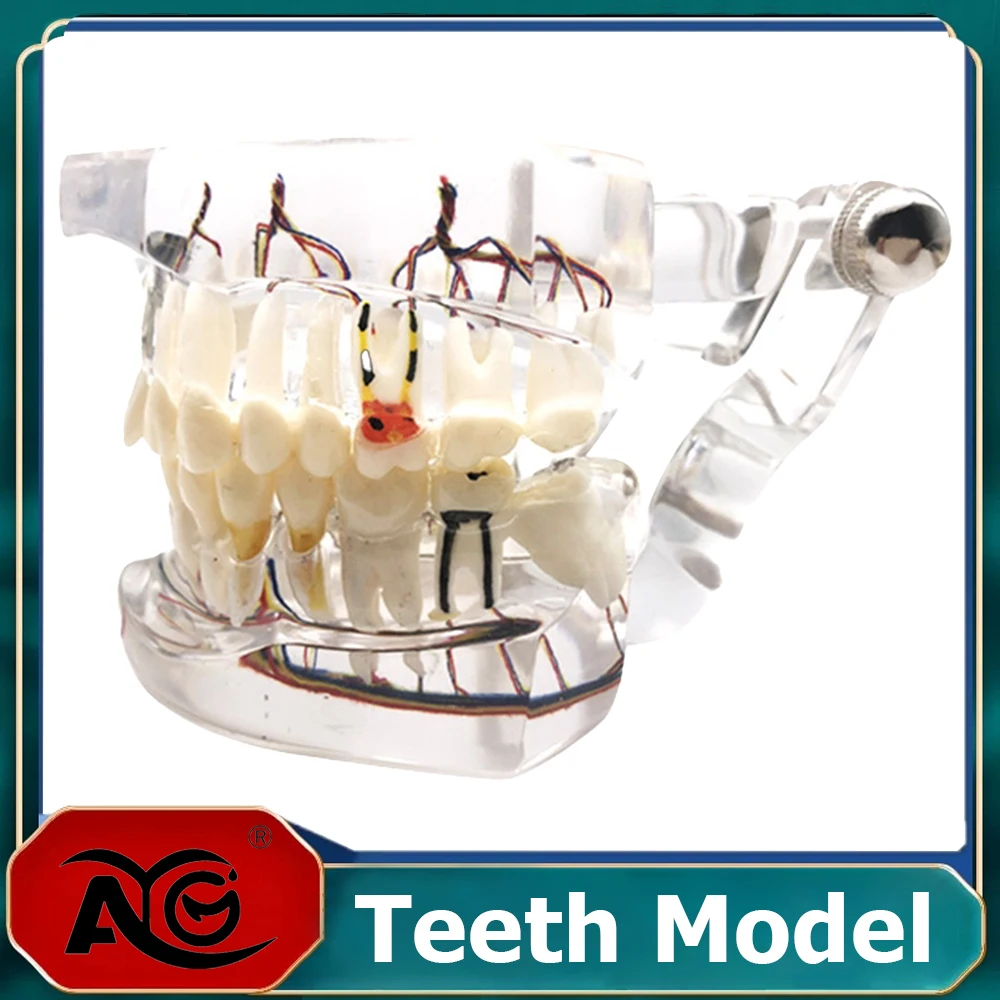 AG Teeth Neural Repair Dental Implant Pathological Model Dentist Students Communication Learning Research Oral Disease Teaching