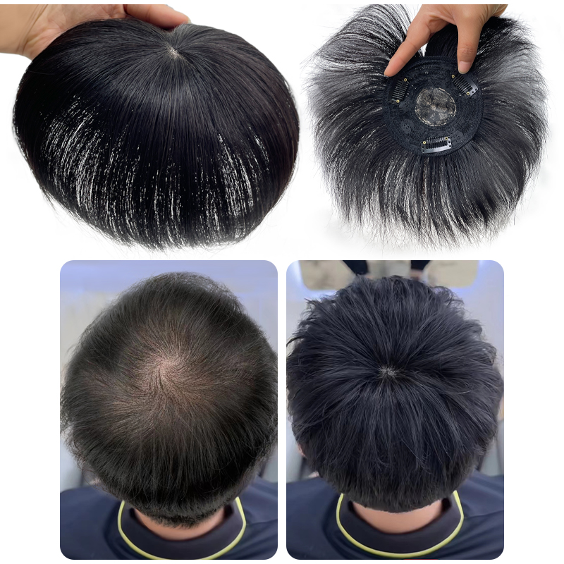 Heren Pruik Menselijk Haar Toupetje Zwitserse Kanten Stukken Pruiken Natuurlijke Ademende Verdunning Haar Cover-Up Voorhoofd Kalende Verhulling
