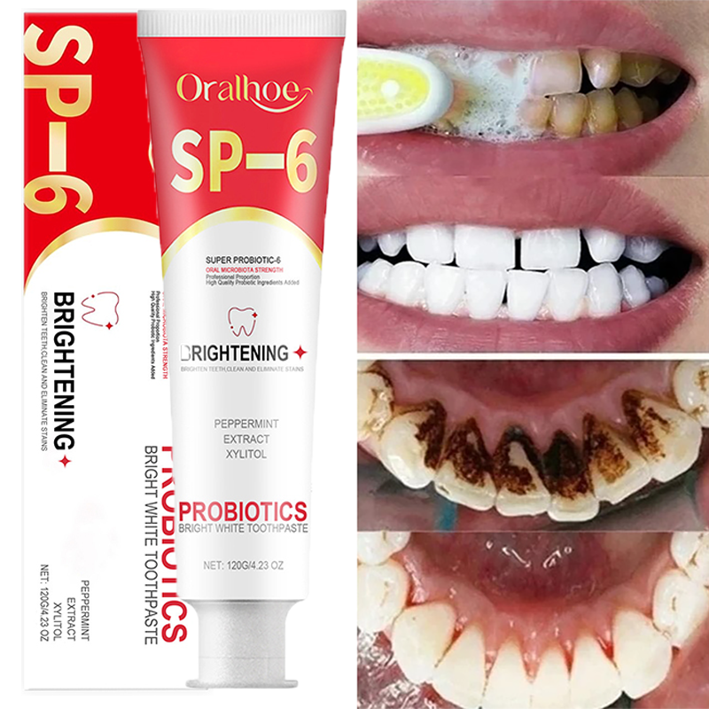 SP-6 Probiotische Tandpasta Witter Schone Tanden Verwijderen Vlekken Mondverzorging Beheer Frisse Adem Met Natrium Saccharin Lactobacillus