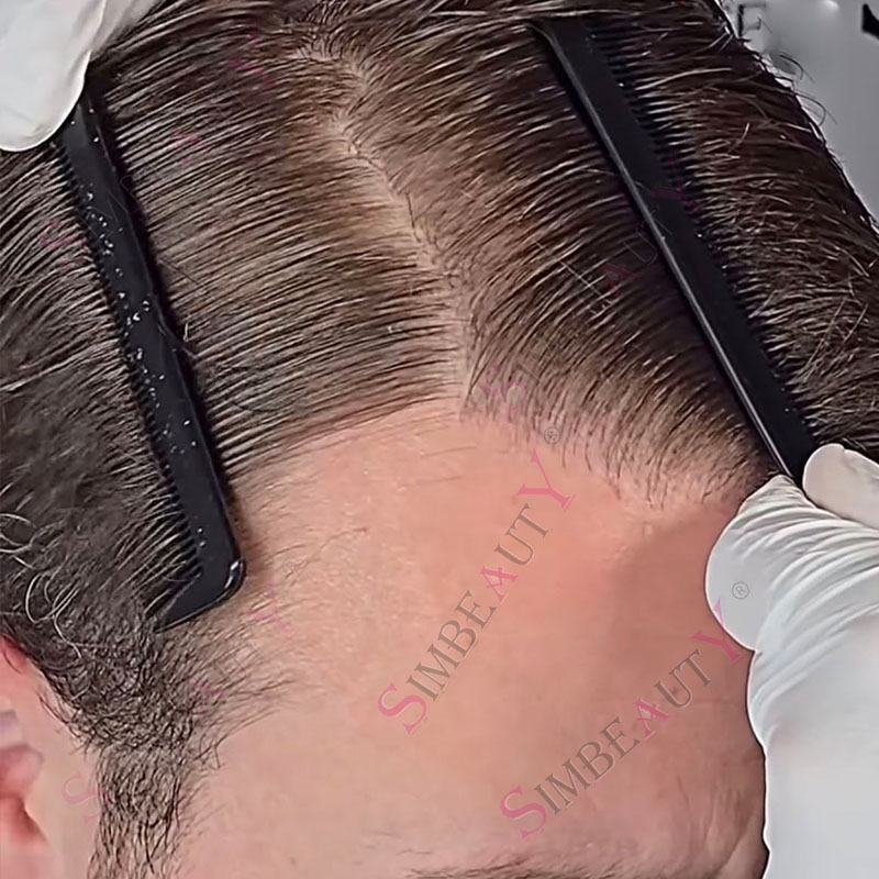 80% densidad 0,02mm indetectable piel ultrafina marrón oscuro hombres peluquín negro gris 1B20 sistema de cabello humano prótesis de línea de cabello Natural