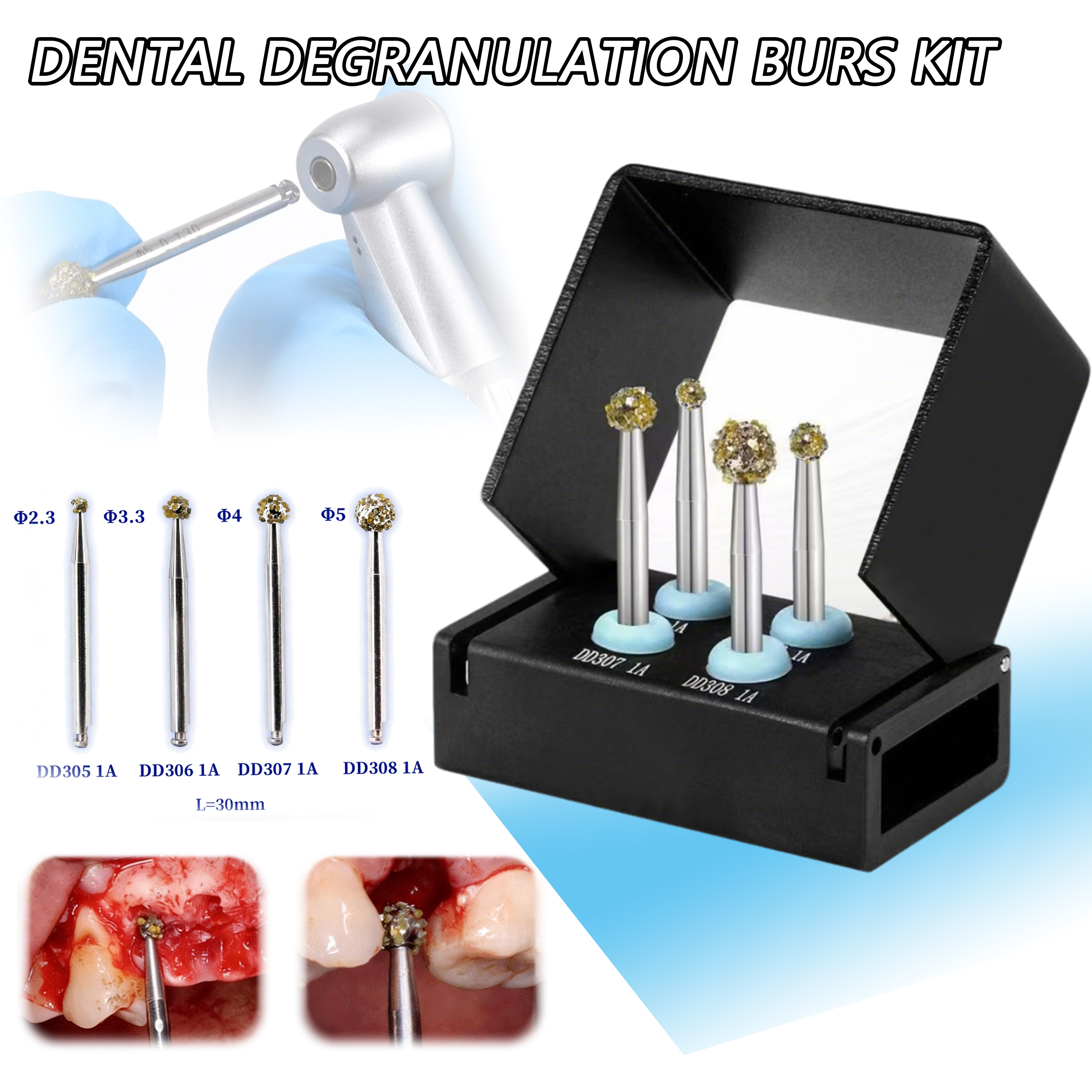 Kit de Fresas Dentales para Desbridamiento Óseo y Eliminación de Tejidos Blandos, Fresas de Diamante Esféricas Φ2.3 Φ3.3 Φ4.0 Φ5.0