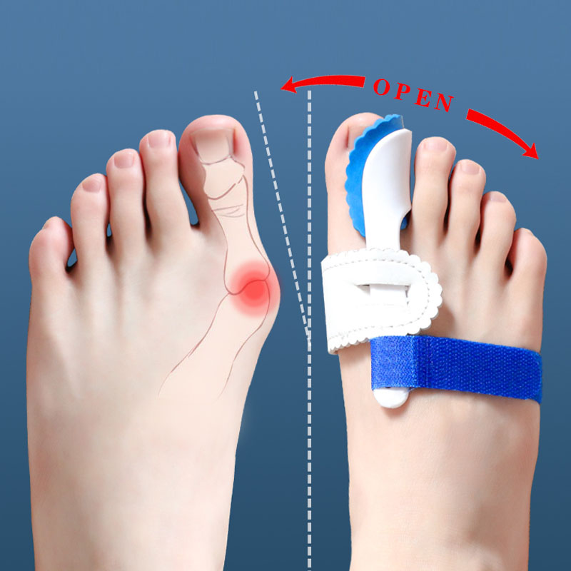 Hallux Valgus Corrector เท้าสําหรับนิ้วเท้าแยก Haluksy Bunions Hallux Valgus Toe Spreader Toe Separators Toe Corrector Bunion