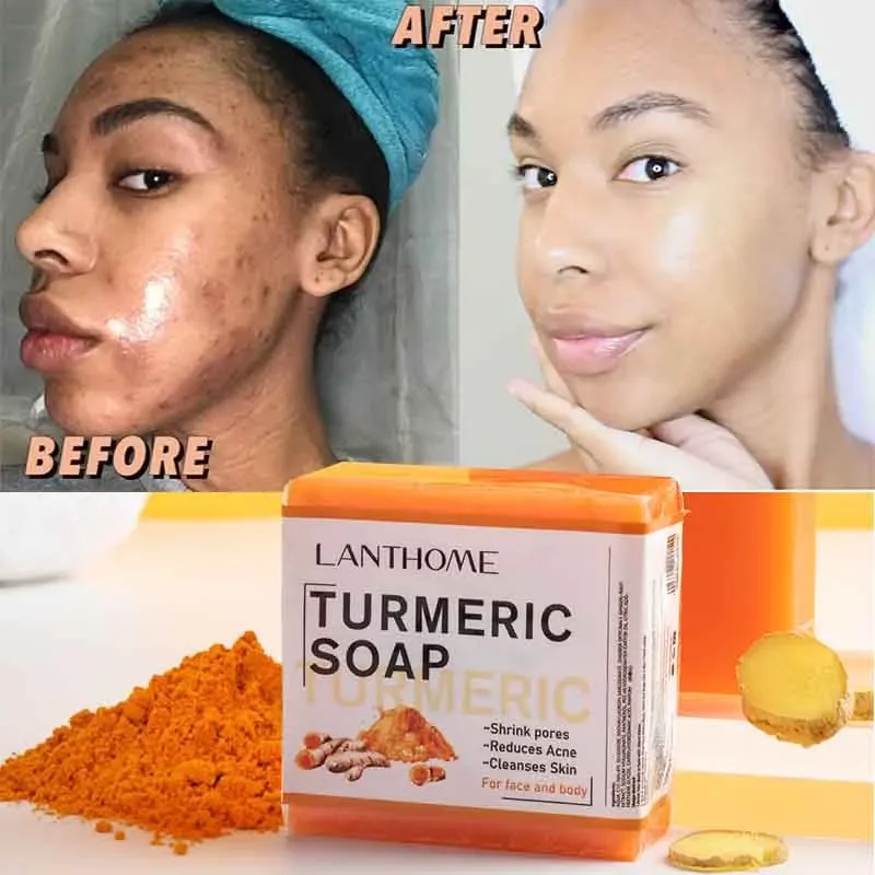 Jabón de cúrcuma para limpieza facial, dispositivo para blanquear la piel, elimina espinillas, manchas oscuras, aclara el jengibre, hecho a mano