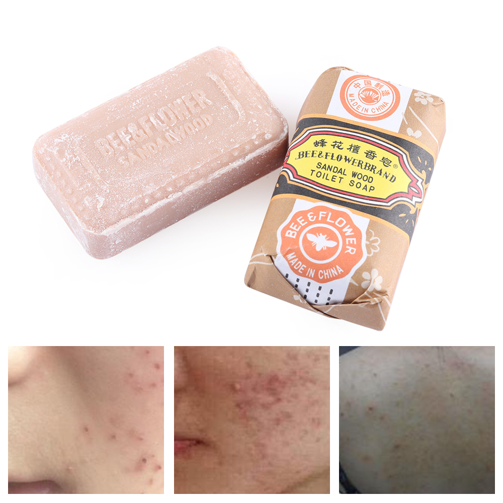 Jabón blanqueador de sándalo, eliminador de espinillas y nariz, limpiador antibacteriano para baño, ducha, cuidado de la piel, 25g