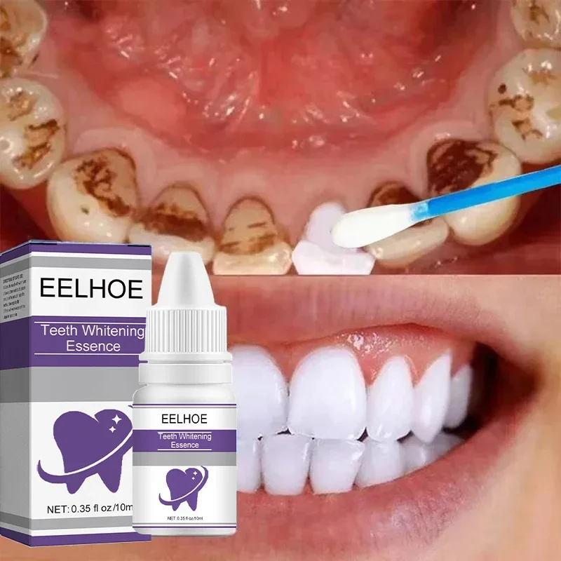 Reiniging Tandenbleken Essentie Effectief Verwijderen Plaque Serum Gele Tanden Tandvlekken Verwijdering Serum Frisse Adem Tandpasta