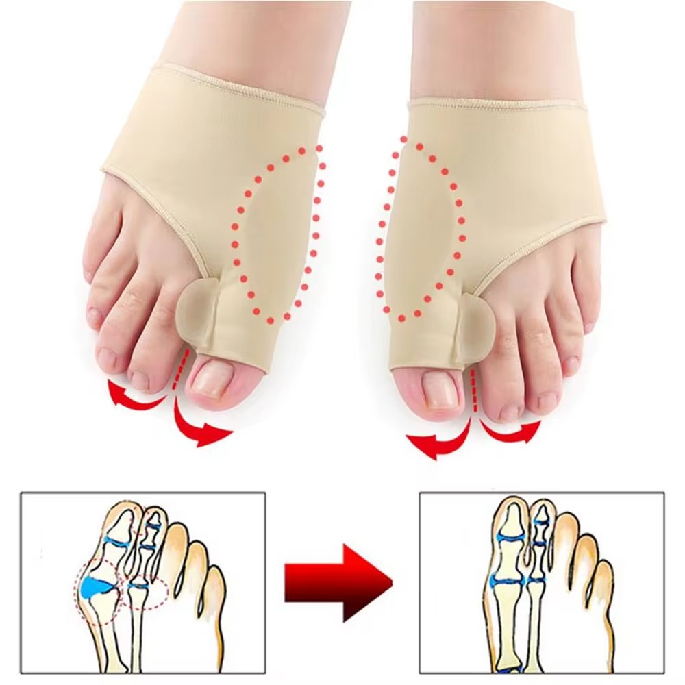 1 คู่ Toe Separator Hallux Valgus Bunion Corrector HAMMER Toe Straightener บรรเทาอาการปวดเท้าศัลยกรรมกระดูก Pedicure เครื่องมือ Foot Care