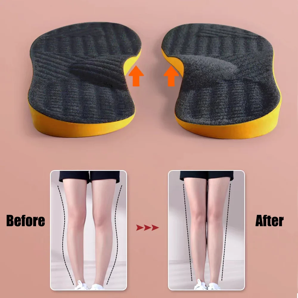 Orthotic Insole Arch Support Flat Foot Orthopedic Insoles for Shoes Women Men X/O Type Legs Valgus Feetn Shoe Pads Deodorization