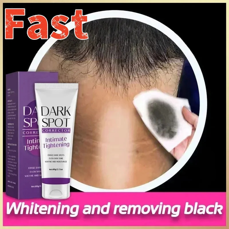 Crema iluminadora de nicotinamida para piel oscura, crema iluminadora efectiva para aclarar el blanqueamiento interior del muslo, elimina la melanina, partes privadas
