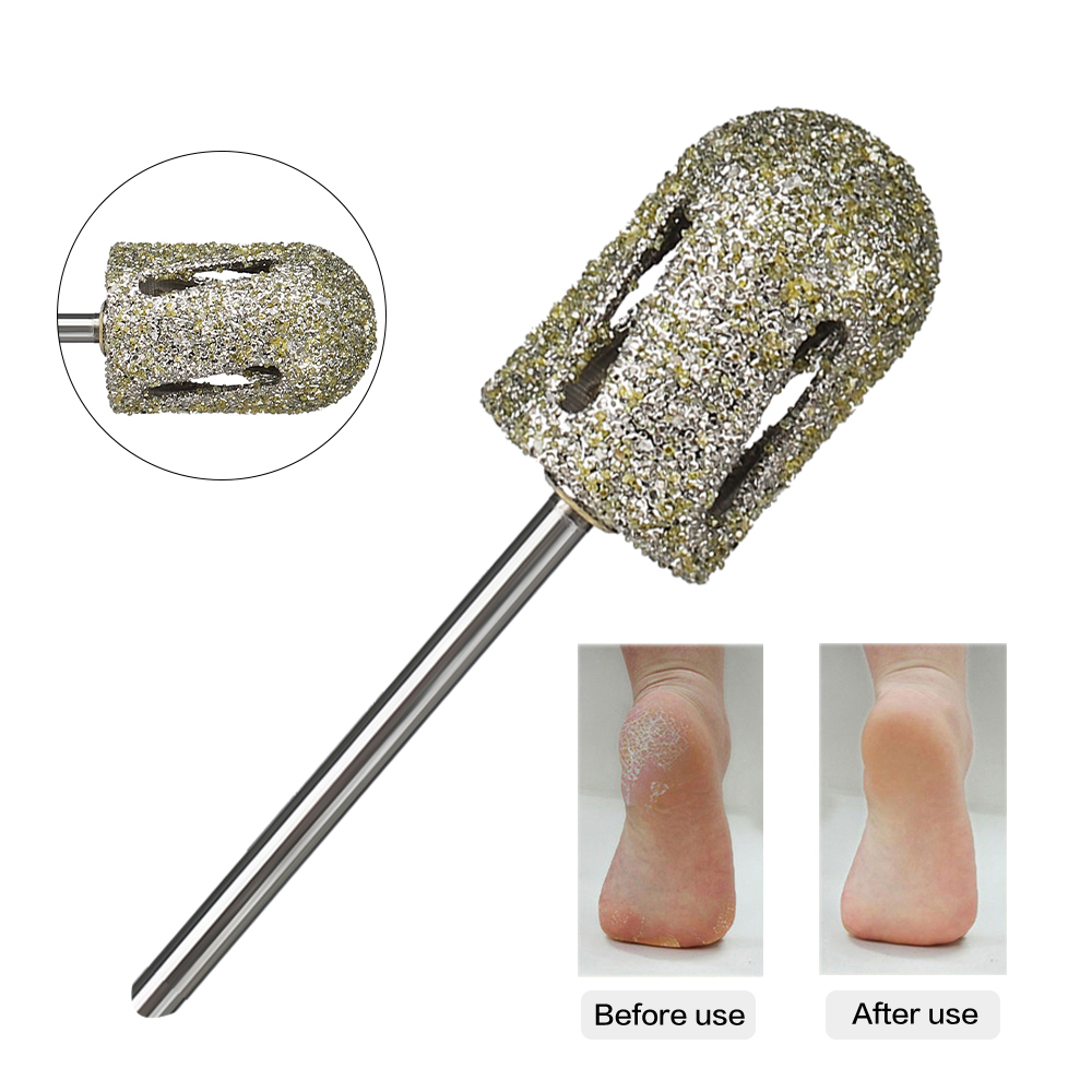 Berlian Pedikur Kerucut Bit untuk Kulit Retak Jagung Kalus Penghapusan Kaki Pengajuan Alat 3/32 "Rotary Burrs Pedikur Kuku Bor Bit