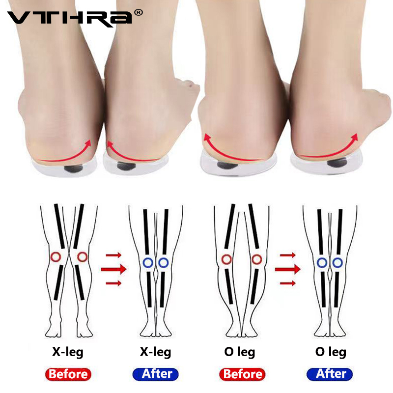 Plantillas ortopédicas de silicona con imanes, herramienta para el cuidado de los pies para hombres y mujeres, cuidado de la salud, tipo O/X, piernas, rodilla, varus, corrección, almohadillas para el talón, 1 par