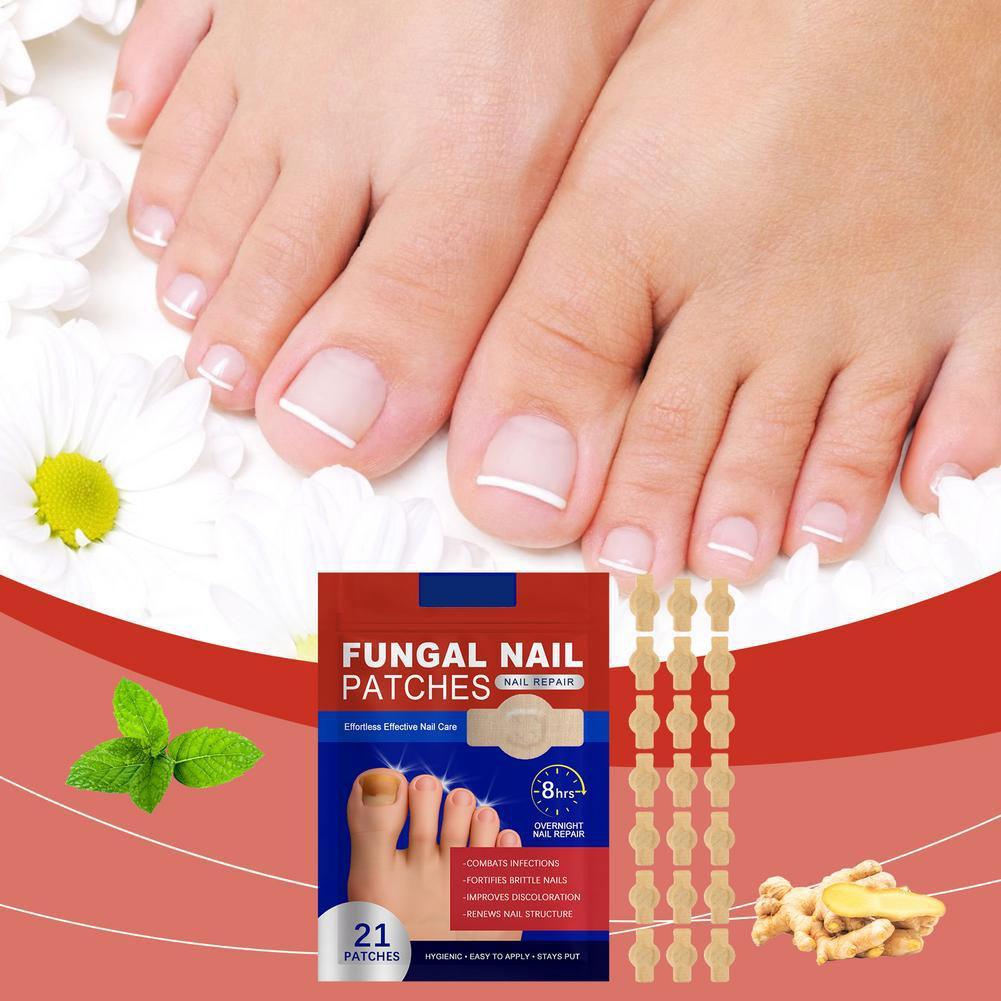 Fungal Nail Repair Patches Plant Extract Painless Nail Ingrown Correction Stickers Nails Care Recover Pedicure Treatment Tools