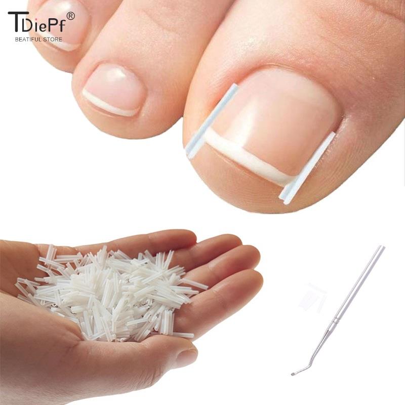 50 unid/caja herramienta de corrección de uñas encarnadas tratamiento de uñas encarnadas parche elástico pegatina Clip alisador herramienta de pedicura