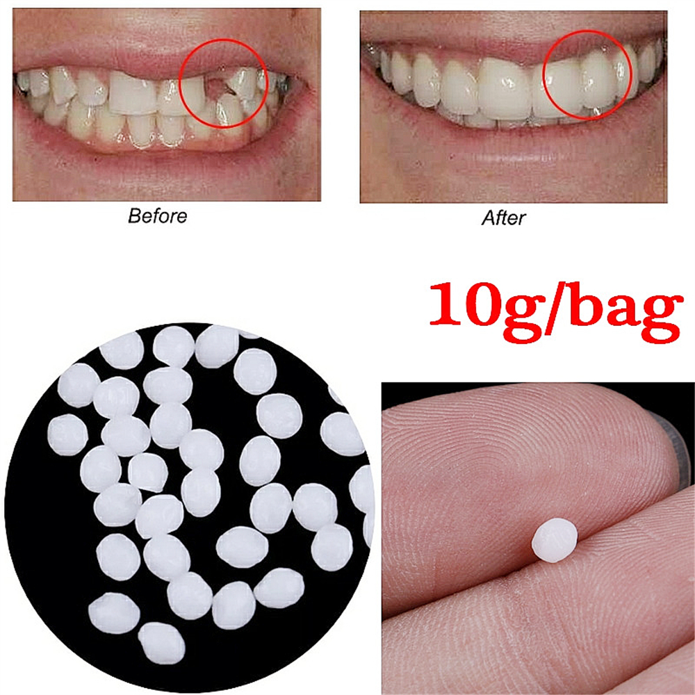 Kit de Reparación Dental de 10g/Bolsa - Perlas Térmicas para Rellenar y Reparar Dientes Rotos o Adherir Prótesis Dentales