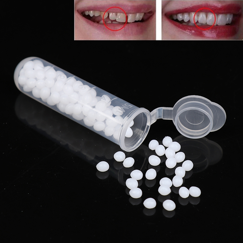 Kit de réparation dentaire temporaire 1 boîte – Colle solide pour dents et espaces, outil de beauté dentaire, adhésif pour prothèses, blanchiment des dents