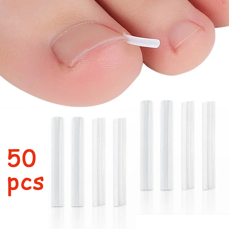 50 Pz Strumento di Correzione dell'unghia del piede incarnita Invisibile Trattamento delle unghie dei piedi incarnite Pad Scanalatura Raddrizzamento Clip Brace Strumento di cura del piede