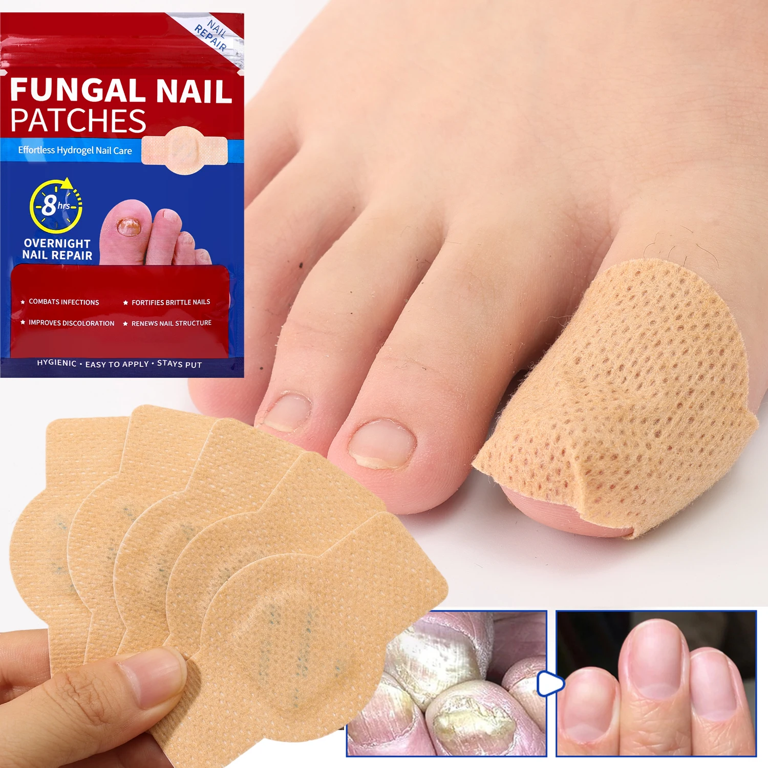 21 Parches Impermeables para Hongos en las Uñas, Adhesivos Correctivos para Uñas Encarnadas, Reparación de Uñas Grises Dañadas, Herramientas para el Cuidado de los Pies