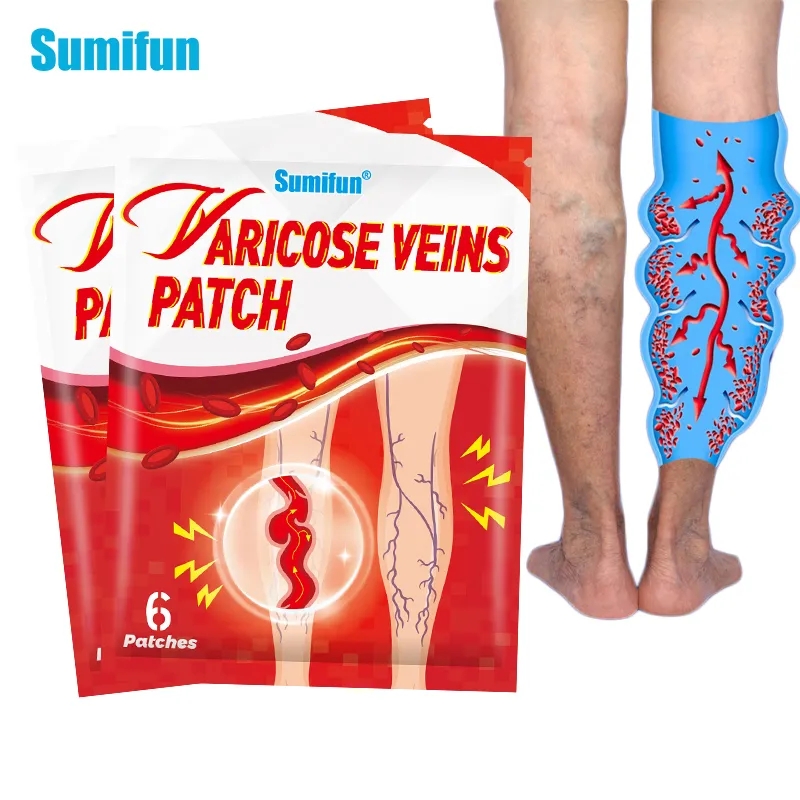 Parche para venas varicosas, crema de araña para Vasculitis, flebite, varicosidad, angiitis, eliminación de ungüeta, yeso médico a base de hierbas, 6-60 Uds.