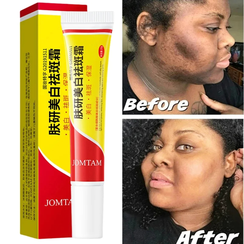 Crema aclaradora facial de niacinamida, sangrado cloasma, melasma, melanina, desvanecimiento, líneas finas, aclara la piel oscura, suero, crema iluminadora para el cuidado