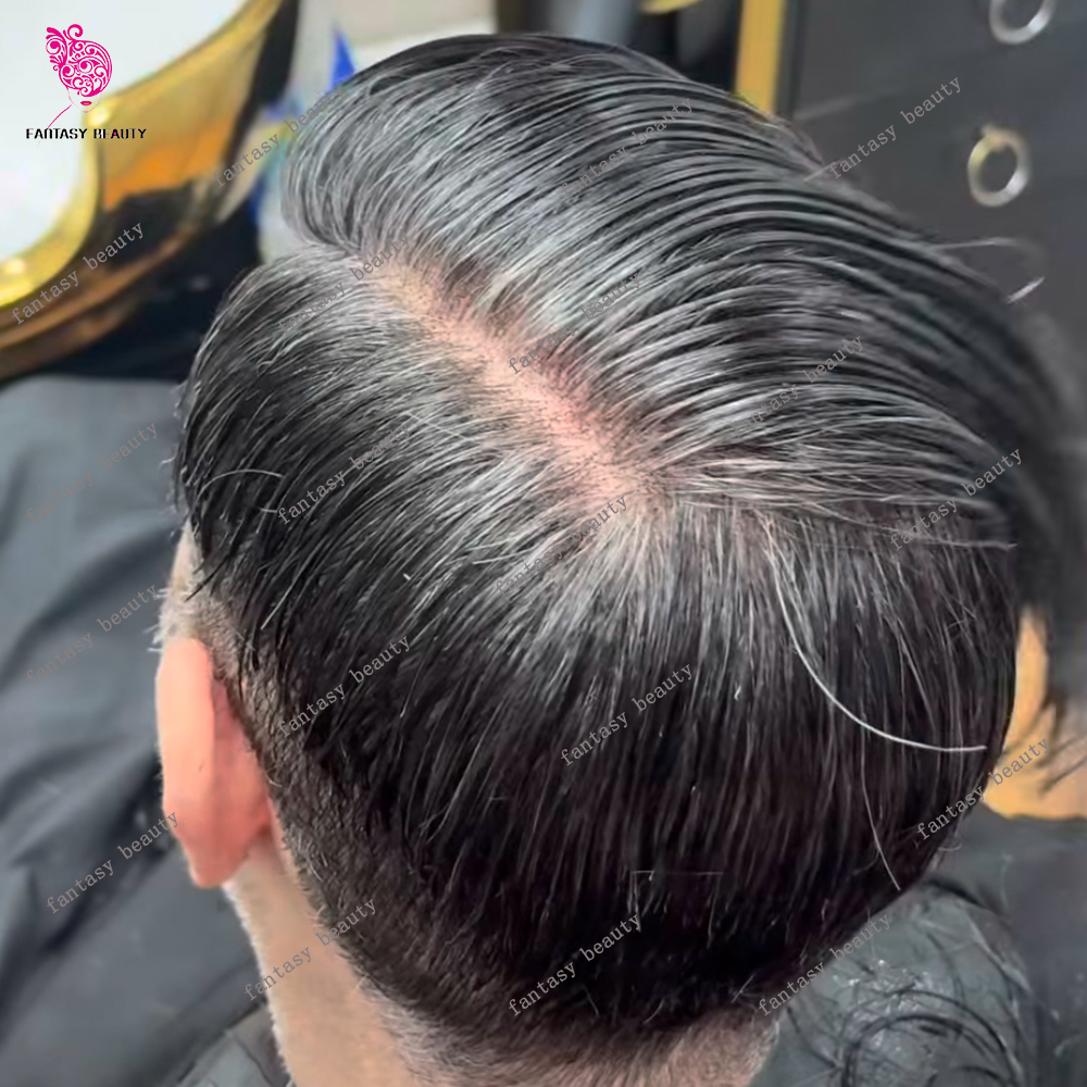 Prótesis Capilar Masculina de Cabello Humano con Base de Piel Resistente, Sistema de Reemplazo para Calvicie, Línea de Cabello Natural Escallopada, Negro Marrón